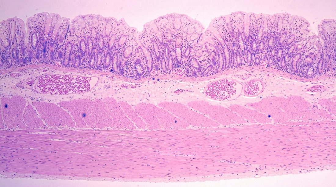 Everyday Habits That Influence Gut Motility