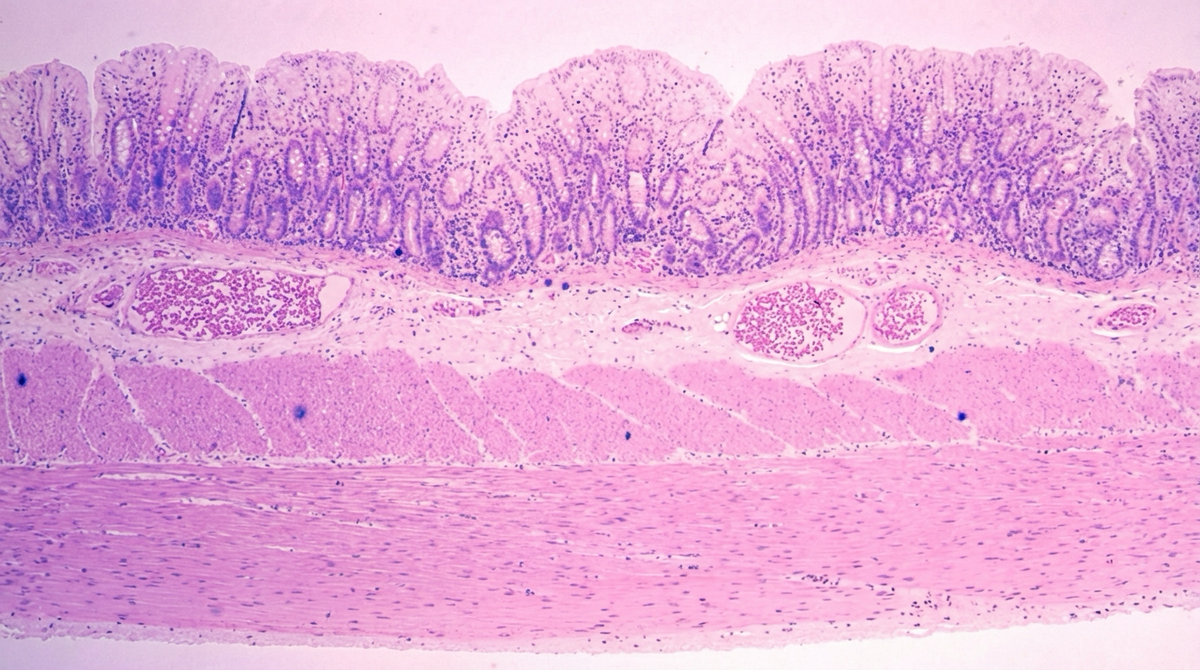 Everyday Habits That Influence Gut Motility